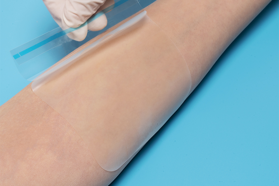 Hydrocolloïde wondverband